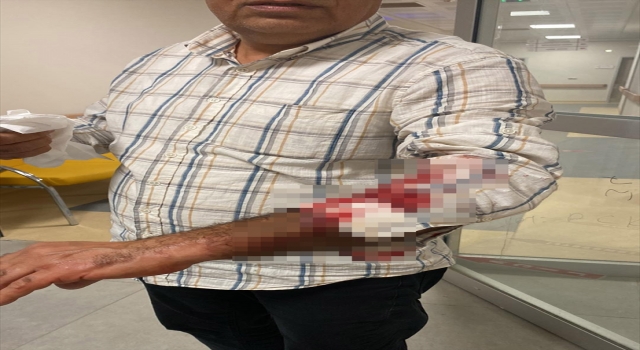 Hatay’da sahipsiz köpeklerin saldırdığı kişi yaralandı
