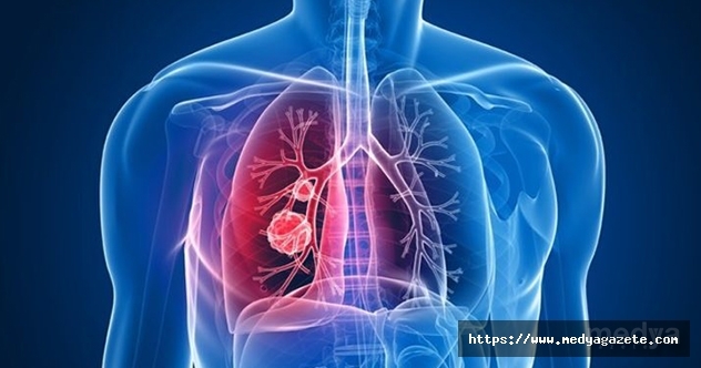 En Sık Rastlanan Akciğer Hastalığı: KOAH