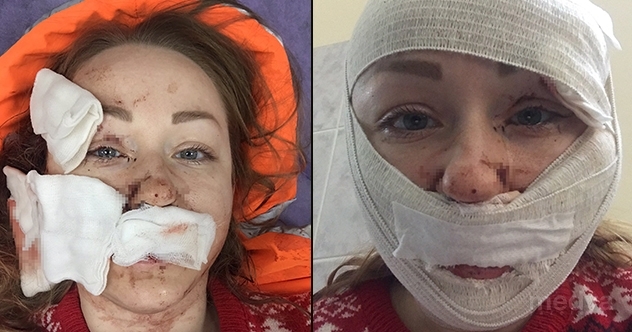Falçatalı saldırıya uğrayan kadından sosyal medyada yardım çığlığı