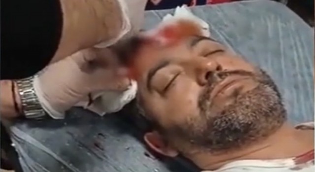 Avukata beyzbol sopalı saldırıda bulunan sanık ilk celsede tahliye edildi