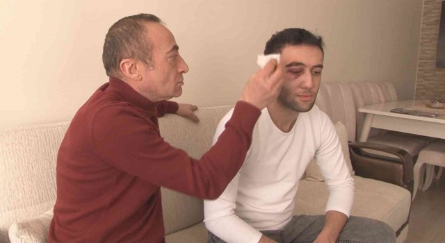 Darp edilen A101 çalışanı: “Bir şeker uğruna saldırıya uğradık”