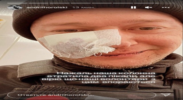 Orduya katılan Ukraynalı müzisyen, Rus saldırılarında yaralandı