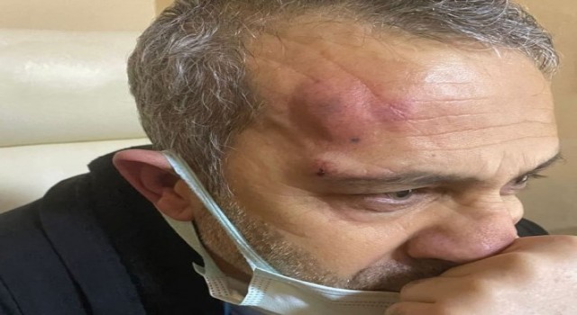 Şanlıurfada hasta yakınları sağlık çalışanını darp etti