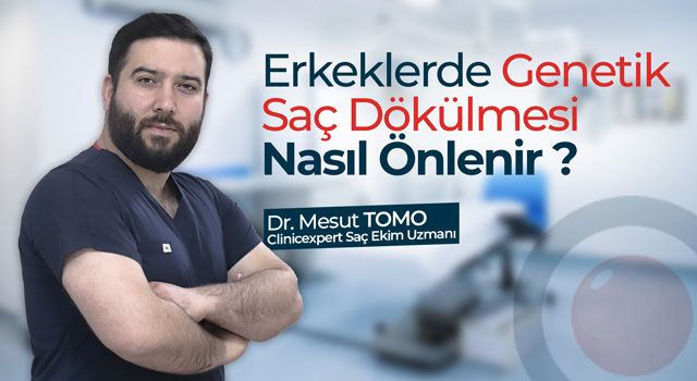 Erkeklerde Genetik Saç Dökülmesi Nasıl Önlenir?