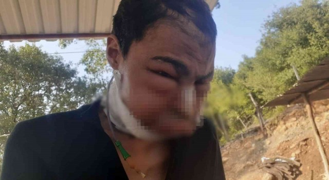 Yakalandığı hastalık kabusu olmuştu, hayatını kaybetti