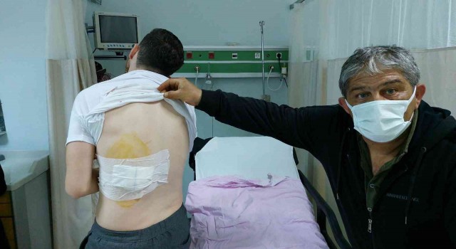 Ankaradan bayram için geldiği Samsunda sokak köpeğinin saldırısına uğradı