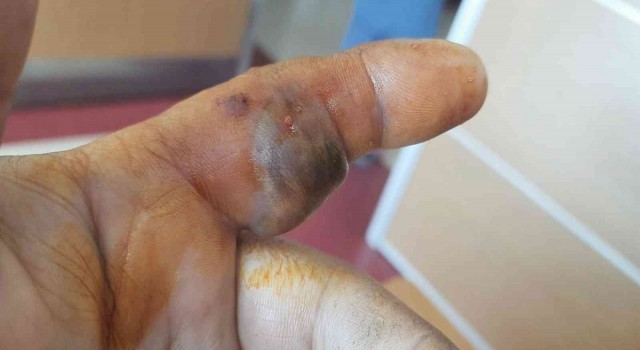 Bursada bir adam elini sokan yılanla hastaneye koştu