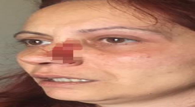 Büyükçekmecede sitede kadına darp iddiası