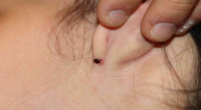 Kulağına kene yapışan küçük çocuk hastaneye kaldırıldı