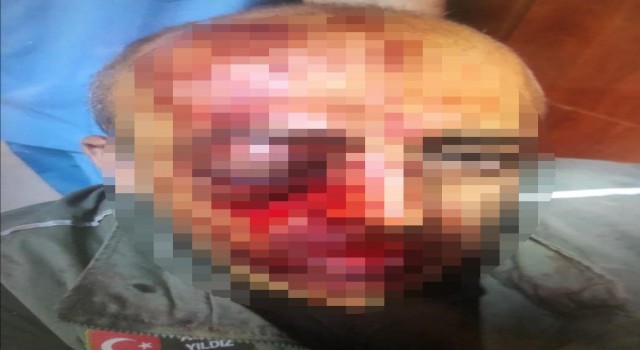Orman muhafaza memurunu darbeden 4 şüpheli gözaltına alındı