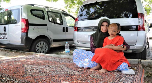 Yangında yüzü yanan Dilaranın annesi: “Allah razı olsun Sağlık Bakanlığından, kızımın ameliyatını karşılıyor”
