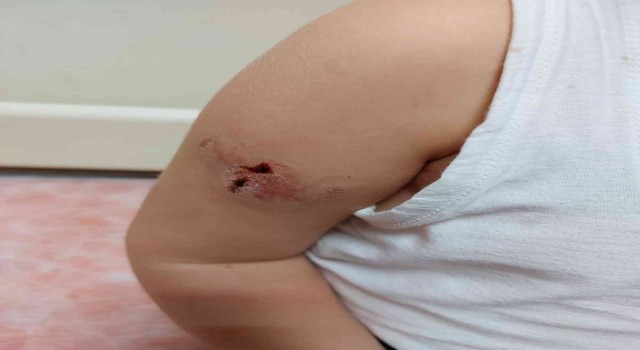 Zonguldakta sahipsiz köpekler 5 yaşındaki çocuğa saldırdı