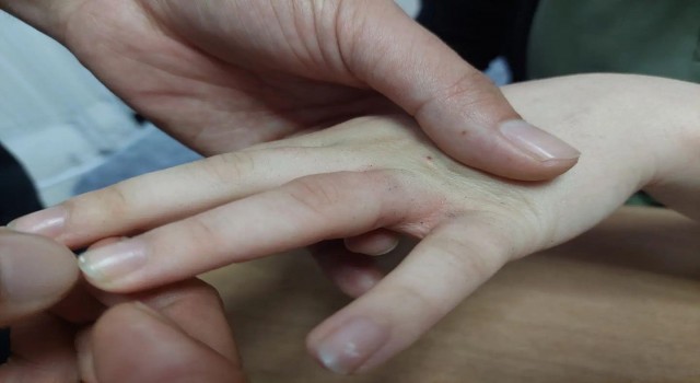 15 yaşındaki gencin parmağına sıkışan yüzüğü AFAD ve sağlık ekipleri çıkardı