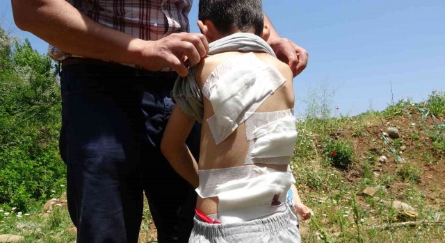 Bingölde 6 yaşındaki çocuk köpeklerin saldırısına uğradı