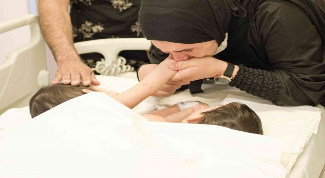 Cezayirli yapışık ikizler Türkiyede 9 Saat süren operasyonla ayrıldılar