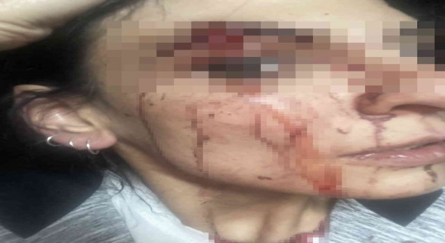 Esenyurtta site içerisinde alkol aldığı iddia edilen kadınları tekme tokat dövdüler