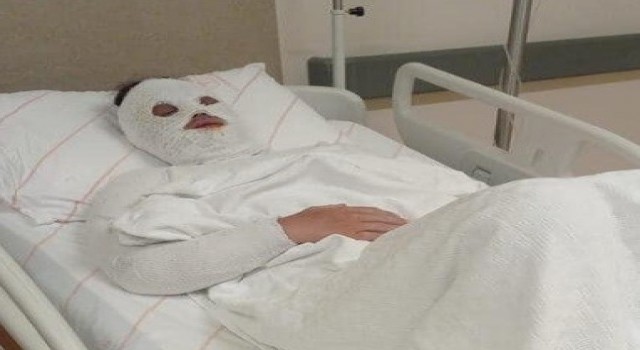 Eski nişanlısına kezzap atan şahıs Su saatine bakacağım bahanesiyle kapıyı açtırmış