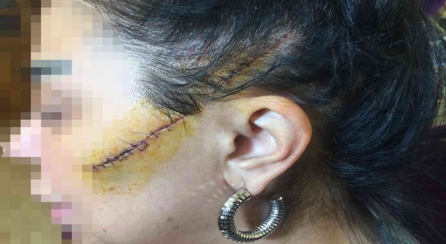 Eski sevgilisinin yüzünü usturayla kesen aşığa ‘indirimsiz 6 yıl ceza