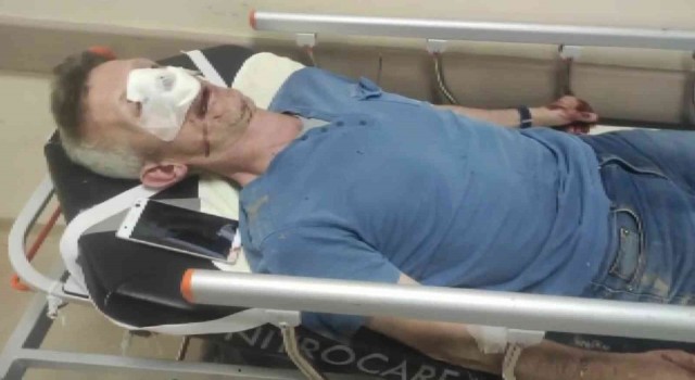 (Özel) Sitedeki fahiş zam için eylem yaptı, yöneticiden dayak yedi