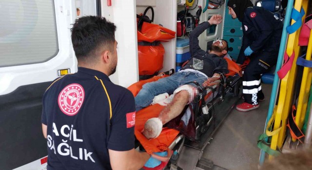 Samsunda silahlı saldırı: 1 yaralı