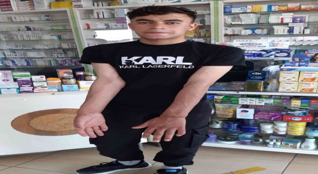 Sultangazide “Maymun Çiçeği” iddiası korkuttu