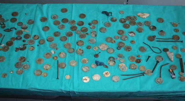 Vanda akıl almaz olay: Midesinden 83 TL madeni para çıktı