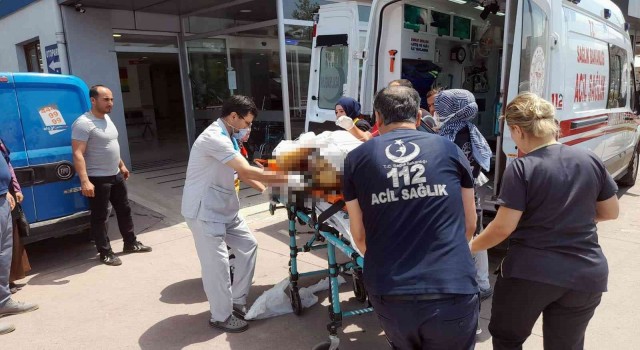 Zonguldakta bir kadın kendini ateşe verdi