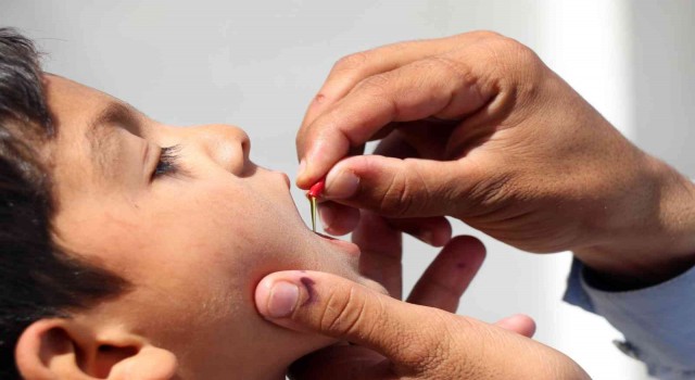 ABDde 2013ten bu yana ilk çocuk felci vakası