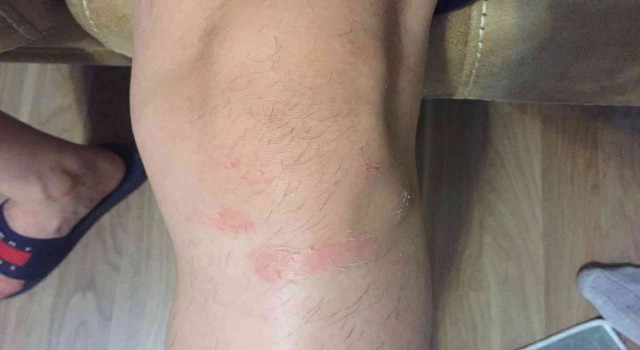 Gazi polise yumruk attı, polis gaziye karakolda işkence yaptı iddiası