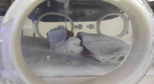 Helikopter ambulansla Şanlıurfaya getirilen 775 gramlık bebeğin tedavisi sürüyor
