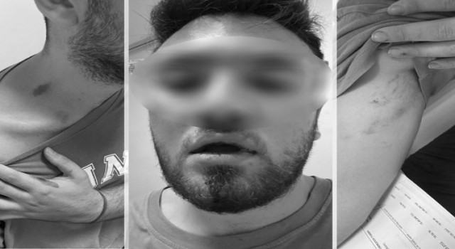 Tıp Fakültesi öğrencilerine emlakçıdan darp ve tehdit iddiası