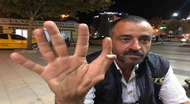 Elazığda 11 parmaklı adam görenleri hayrete düşürüyor