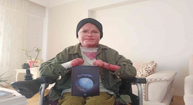 Kelebek hastası Büşra günlüklerini kitap haline getirdi