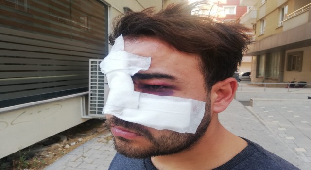 Hatayda istek şarkıyı bilmeyen müzisyenin yüzünde şişe kırdılar