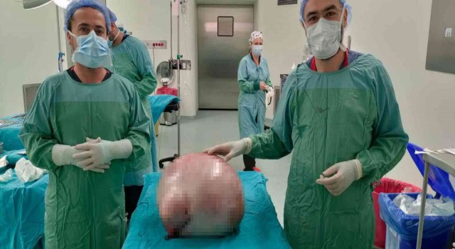 Karnından 35 kilogramlık kitle çıktı