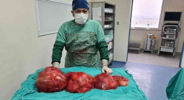 Kilo aldığını sanıyordu, karnından çıkanlar şoke etti