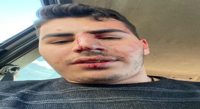 Küçükçekmecede kafeye gelen müşteri çalışanı darp etti
