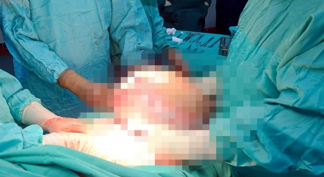 Karnından 7,5 kilo kitle çıktı