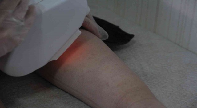 Lazer kadının vücudunu yakmıştı, başka bir güzellik uzmanı tedavisini üstlendi