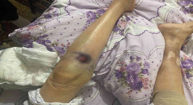 Ankarada bakıcı dehşeti: 91 yaşındaki yaşlı kadın hastanede ölüm kalım savaşı veriyor