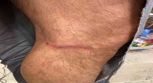 Çankayada başıboş köpekler vatandaşın kıyafetlerini parçaladı