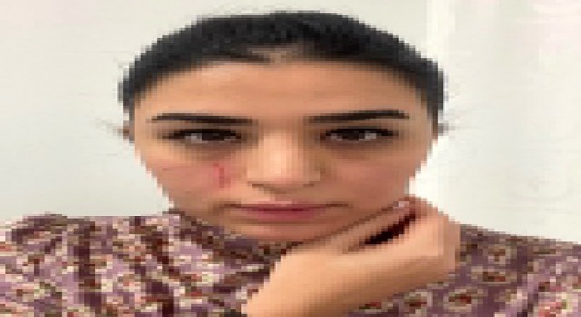 Mersinde kadın doktora saldırı: 2 gözaltı