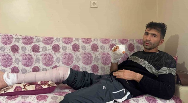 Komşusunun köpeğinin saldırısına uğrayan vatandaşın parmağı koptu, eli parçalandı