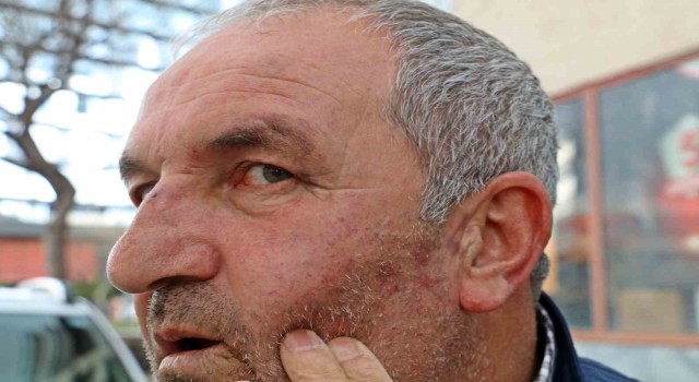 Kulak zarını patlatana kadar dövdüler, ‘Bu değilmiş deyip gittiler