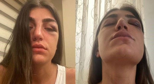 Manken Gizem Akbaşın darp edilmesine ilişkin davada sanığa 1 yıl hapis talebi