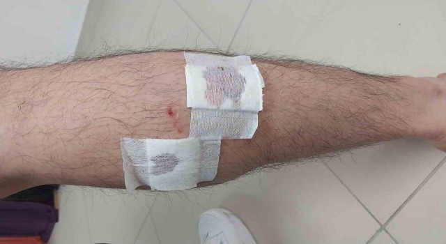 Mersinde sokak köpekleri belediye çalışanına saldırıp ısırdı
