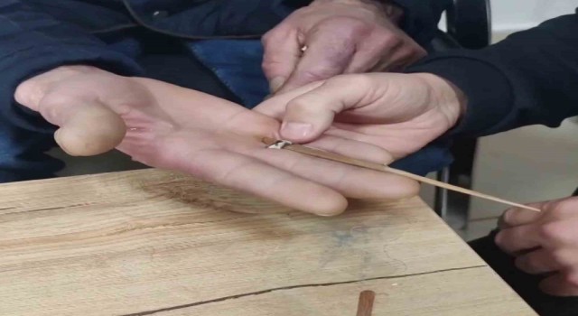 Yüzük parmağına sıkıştı, imdadına itfaiye koştu