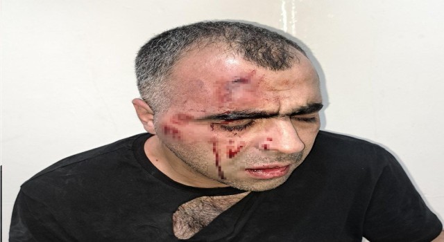 BİGACEM Başkanı Aygüle saldırıya ilişkin 1i polis 2 kişi gözaltına alındı