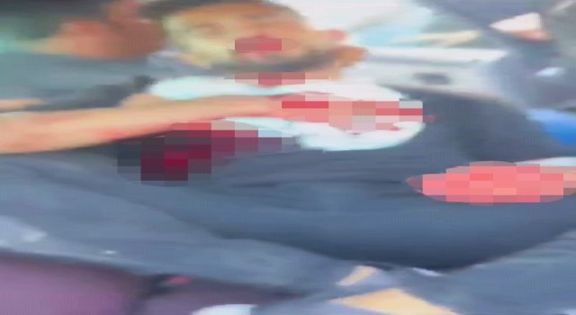 Şanlıurfada akraba iki aile arasında silahlı kavga: 1i ağır 5 yaralı