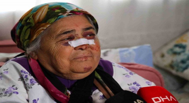 Otomobilin çarptığı yaşlı kadın: Gözümün içine bakıp kaçtı